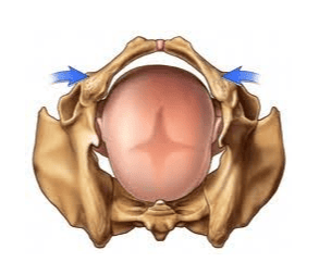 LA PELVIS EN EL PARTO